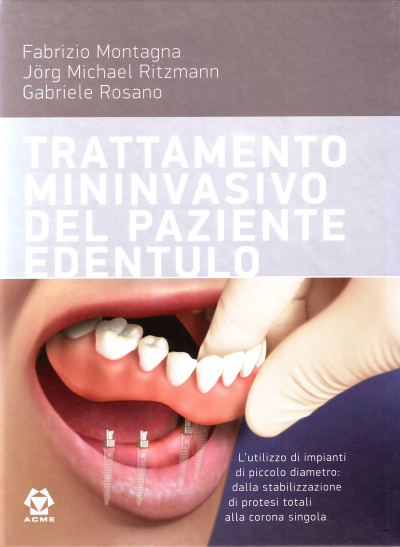 Trattamento mininvasivo del paziente edentulo + DVD